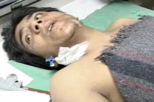 kasab suffered from dengu maleria
